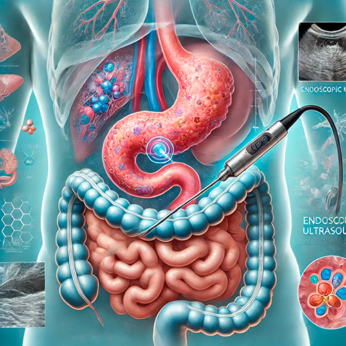 Lesiones focales en páncreas: rol de la ecoendoscopía