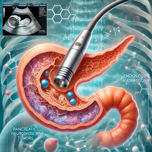 Uso de la ecoendoscopía en el manejo de tumores neuroendocrinos pancreáticos (pNET)